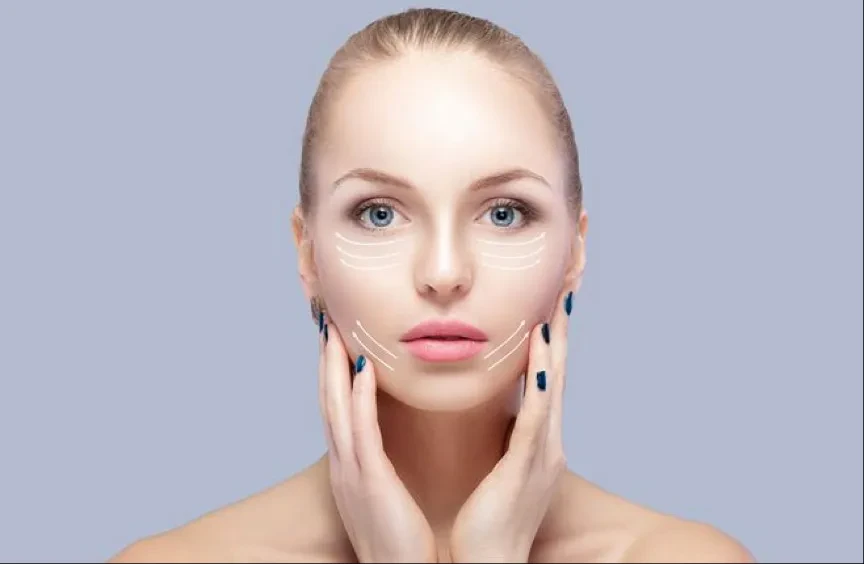 product-864-564